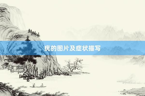 疣的图片及症状描写